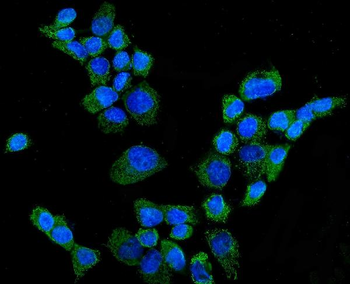 Anti-CYP27A1 Antibody