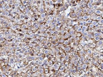 Anti-EGFR Antibody