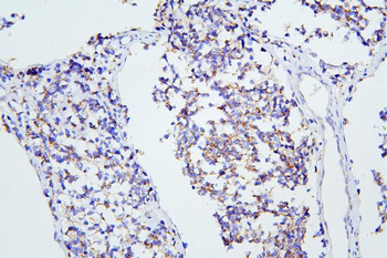 Anti-mGluR1/GRM1 Antibody
