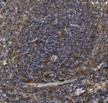 Anti-LY6C Antibody
