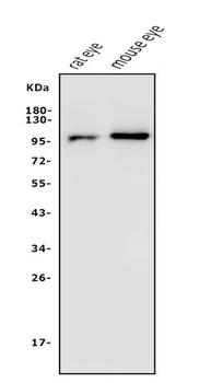 PDE6 beta/PDE6B Antibody