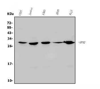 RPA32/RPA2 Antibody