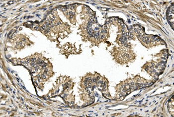 Anti-Nogo A/RTN4 Antibody