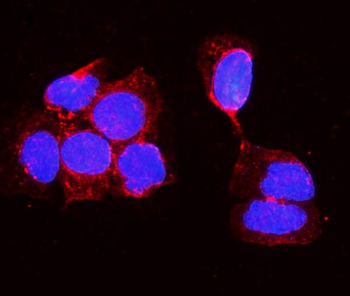 Anti-Alkaline phosphatase/ALPL Antibody