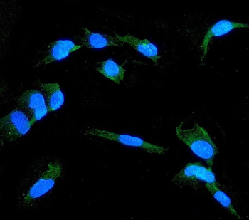Anti-Claudin 1/CLDN1 Antibody