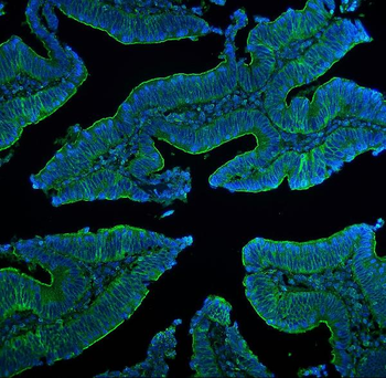 Anti-Claudin 5/CLDN5 Antibody