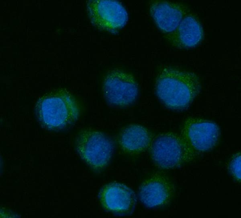 Anti-CYP7A1 Antibody