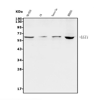 Lgi1/EPT/LGI1 Antibody