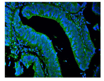 Anti-LPP Antibody