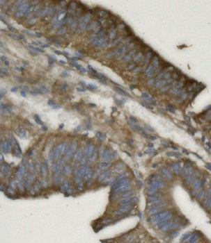 Anti-REA/PHB2 Antibody