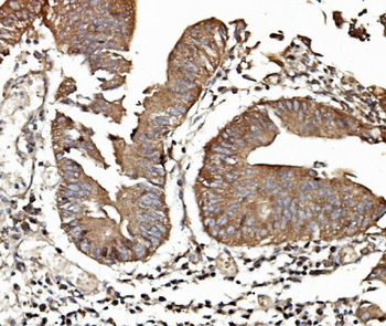Anti-TAB2 Antibody