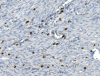 Anti-CD30/TNFRSF8 Antibody