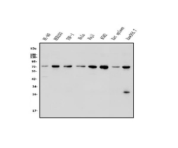 Plzf/ZBTB16 Antibody
