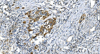 Anti-DRP1/DNM1L Antibody
