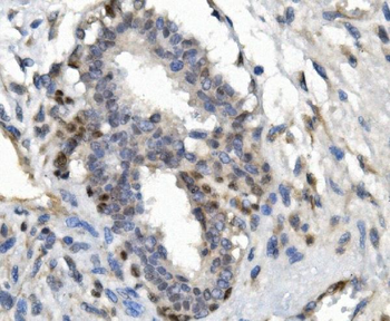 Anti-FOXP1 Antibody