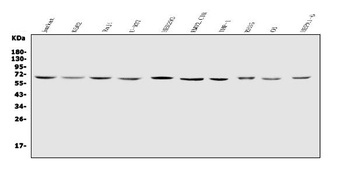 IL2 Receptor gamma/IL2RG Antibody