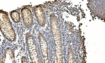 Anti-LSM2 Antibody