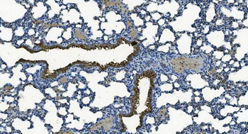 Anti-MCU Antibody