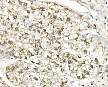 Anti-Slc25a1 Antibody