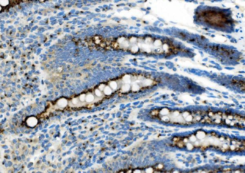 Anti-Golm1/GOLPH2 Antibody