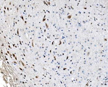 Anti-GRX2/GLRX2 Antibody