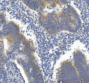 Anti-GDF8/Myostatin/MSTN Antibody