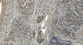 Anti-RGS6 Antibody
