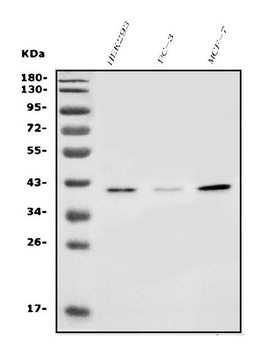 SLC25A19 Antibody