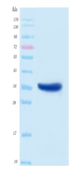 SARS-CoV-2 (COVID-19) NSP5A Protein, His Tag