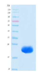 SARS-CoV-2 (COVID-19) NSP8 Protein, His Tag