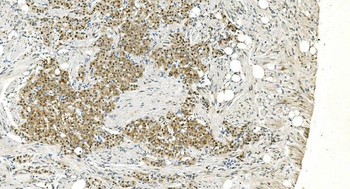 Anti-LSM5 Antibody