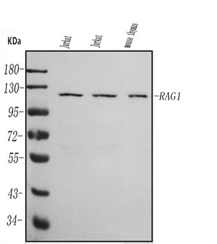Anti-RAG1 Antibody