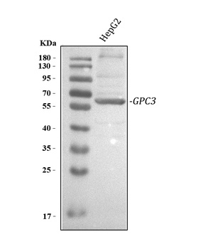 Glypican 3/GPC3 Antibody