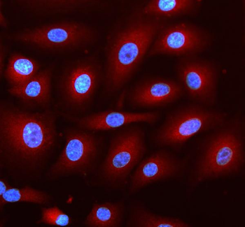 Anti-DNAJC6 Antibody