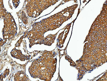 Anti-EEF2 Antibody