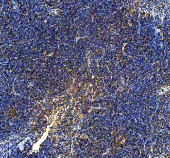 Anti-IL10 Antibody