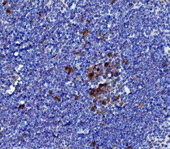 Anti-IL-21/Il21 Antibody