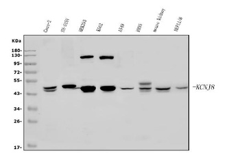 Kir6.1/KCNJ8 Antibody