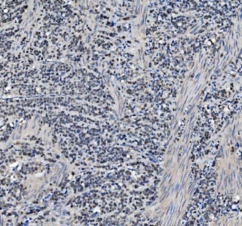 Anti-METTL1 Antibody