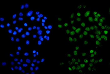 Anti-METTL14 Antibody