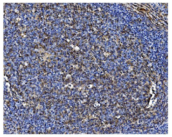 Anti-PCBP1 Antibody