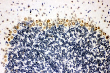 Sumo 1/SUMO1 Antibody