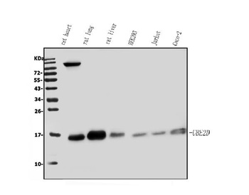 UBE2D1/2/3/4 Antibody