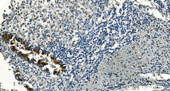 Anti-IDH2 Antibody (monoclonal, 2H4)