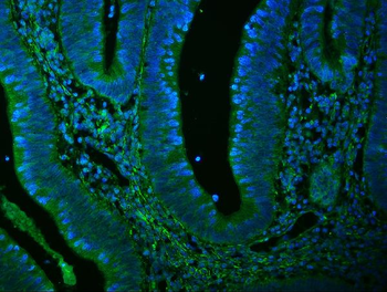 Anti-Filamin A/FLNA Antibody (monoclonal, 3F8)