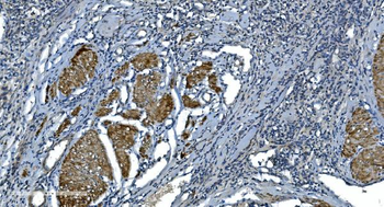 Anti-Actin/ACTA1 Antibody (monoclonal, 3H5)