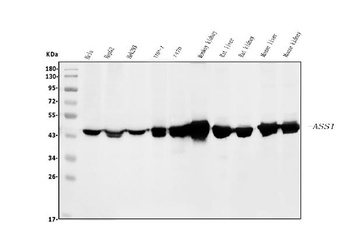 ASS1 Antibody (monoclonal, 7I9)