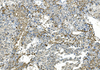 Anti-Fibrinogen beta chain/FGB Antibody (monoclonal, 6D12)