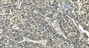 Anti-CD13/ANPEP Antibody (monoclonal, 5B9)