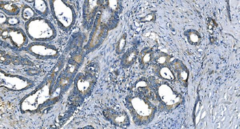 Anti-Carbonic Anhydrase I/CA1 Antibody (monoclonal, 2B5)